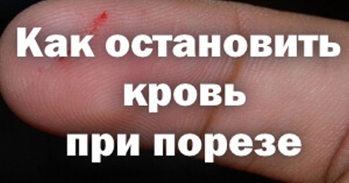 Чем быстро остановить кровь в домашних условиях 577
